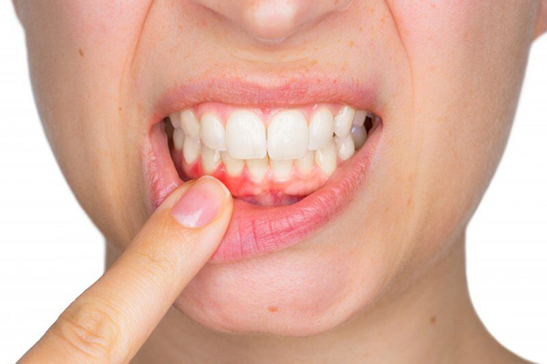 Can Gum Disease Keep You From Getting Cosmetic Work Done?